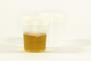 urine test